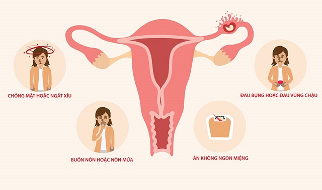 Triệu chứng gặp phải khi mang thai ngoài tử cung