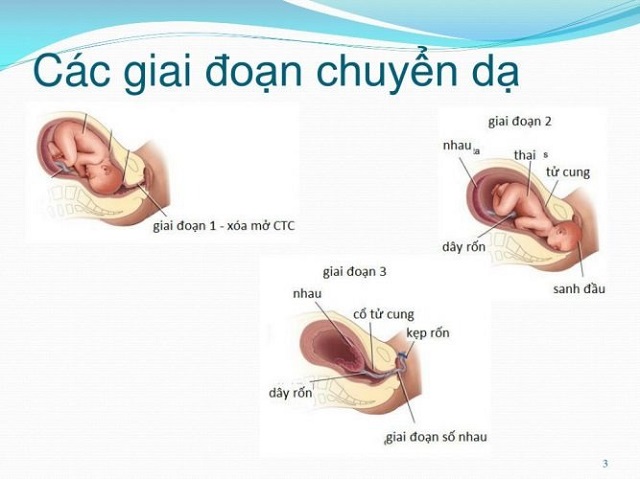 3 giai đoạn chuyển dạ.